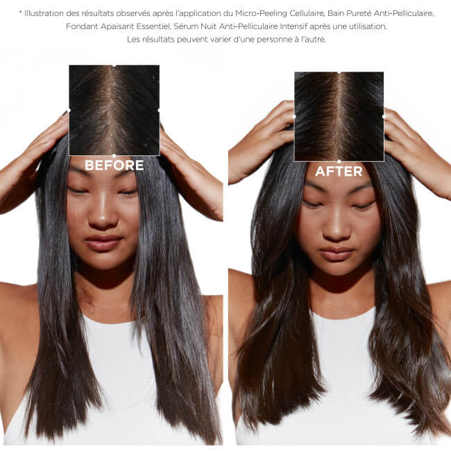 Micro-Peeling Celular Kérastase 200ml