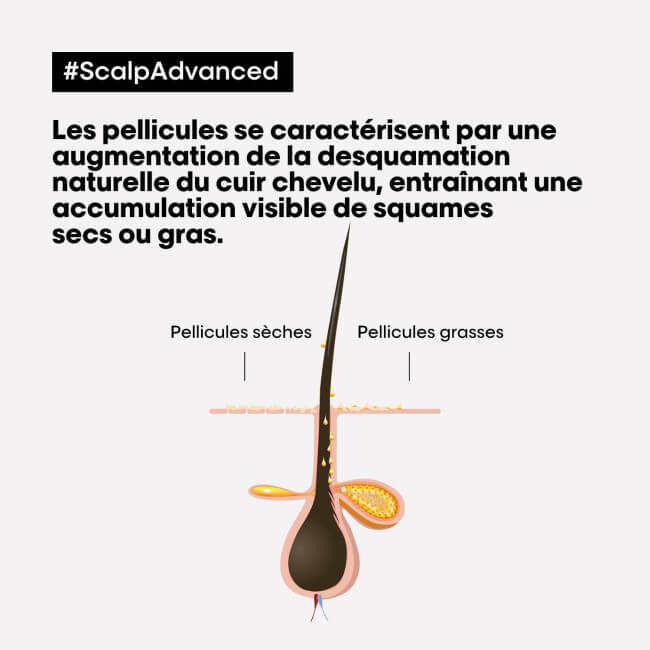 Shampooing Sensi Balance L'Oréal Professionnel 300ML
