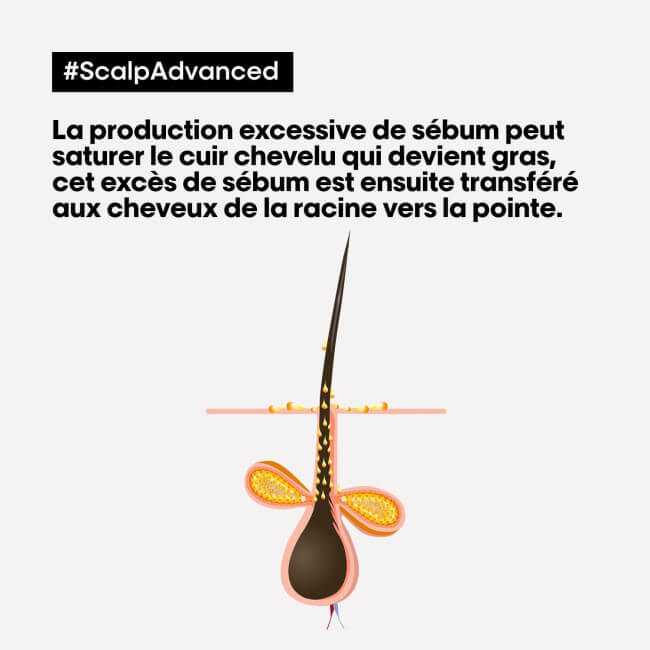 Shampooing Sensi Balance L'Oréal Professionnel 300ML