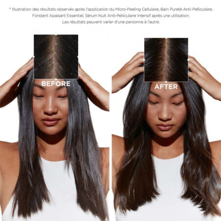 Kérastase Symbiose anti-dandruff purity bath 1L