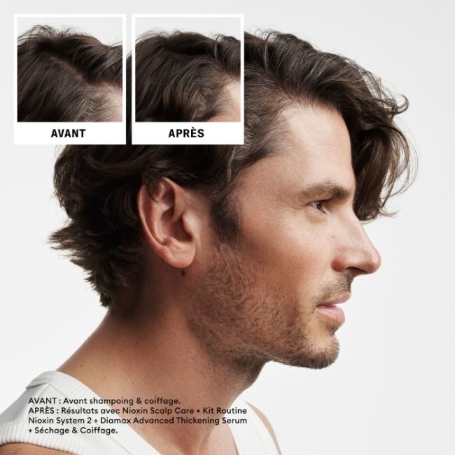 kit de cuidados System 2 Nioxin
