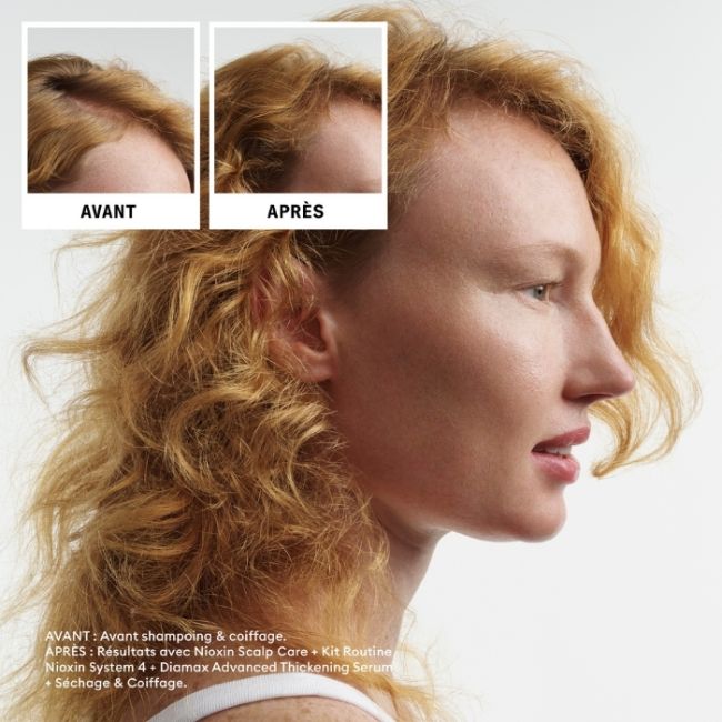 kit de cuidados System 4 Nioxin