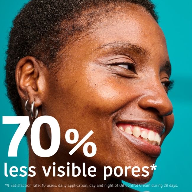 Crème Facial seborreguladora e anti-imperfeições-Acné Iroha 30ml