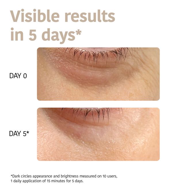 Patch para contorno dos olhos com Niacinamida, Cafeína e Peptídeos Iroha Nature