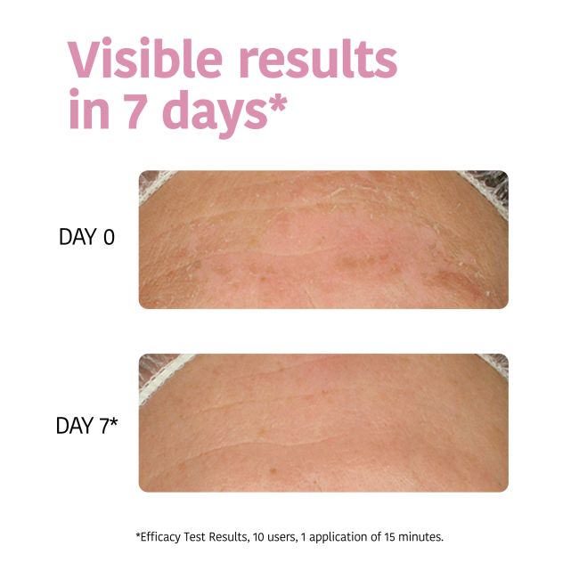 Máscara facial de tecido hidratante IROHA