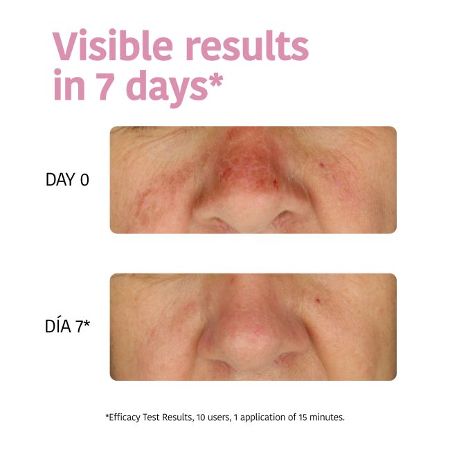 Máscara facial de tecido hidratante IROHA
