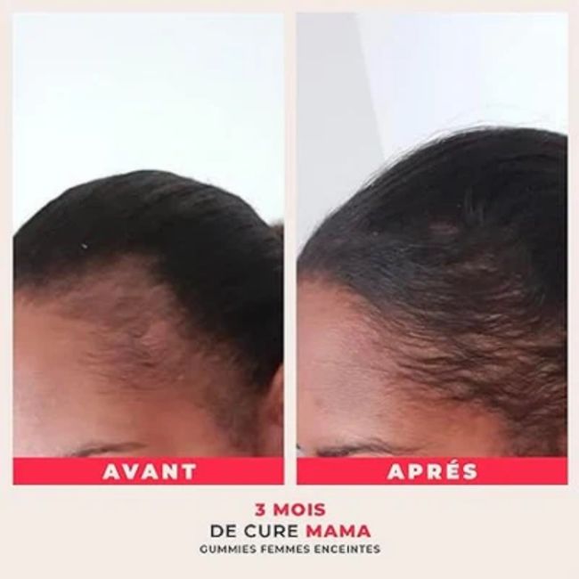 Gomas sem açúcar para mulheres grávidas e lactantes Mama Madame la Présidente