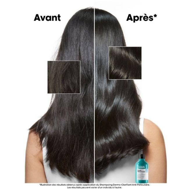 L'Oréal Professionnel Scalp Advanced duo dermo-purificante 300ML