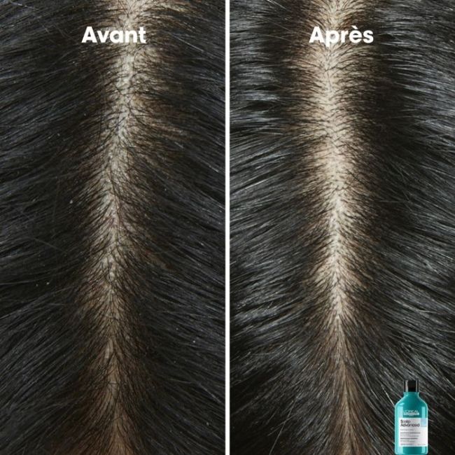 L'Oréal Professionnel Scalp Advanced duo dermo-purificante 300ML