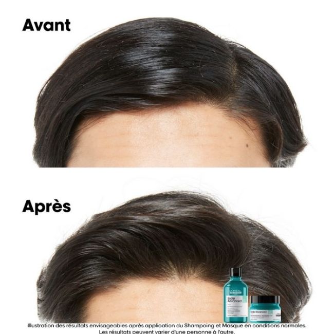 Champô purificante para cabelos oleosos Scalp Advanced L'Oréal Professionnel 500ML
