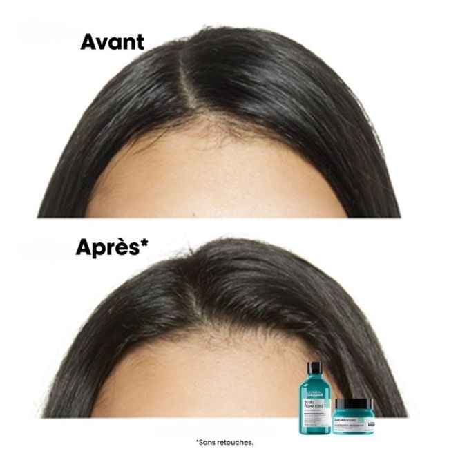 Champô purificante para cabelos oleosos Scalp Advanced L'Oréal Professionnel 500ML