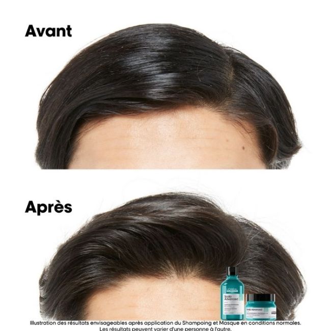 Argile purifiante 2-en-1 cheveux gras Scalp Advanced L'Oréal Professionnel 250ML