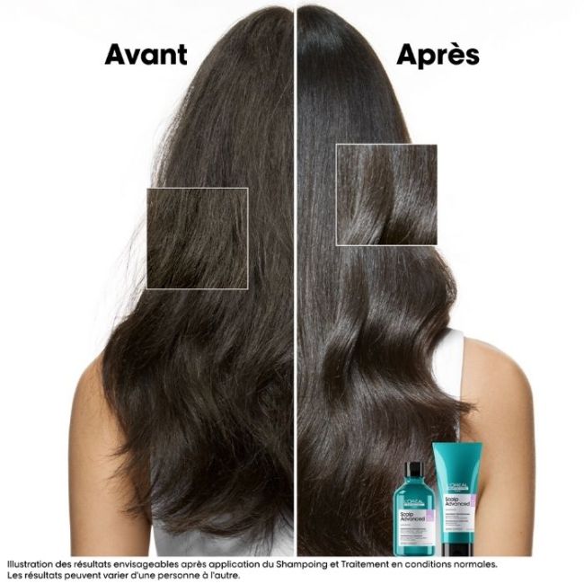 Shampoo dermo-regulerend Scalp Advanced L'Oréal Professionnel 300ML