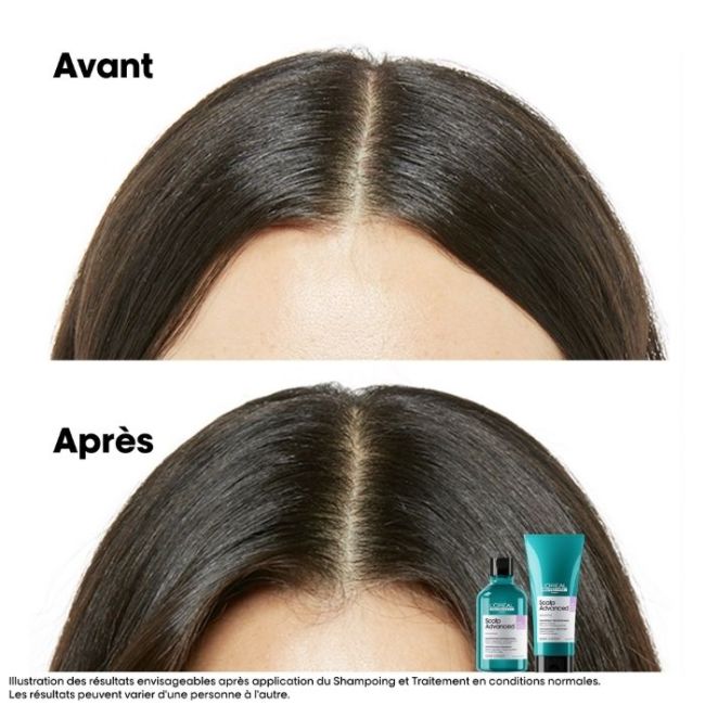 Shampoo dermo-regulerend Scalp Advanced L'Oréal Professionnel 300ML