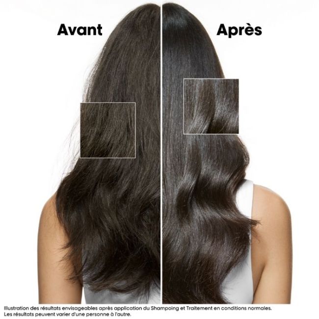 Tratamento apaziguante intenso Scalp Advanced L'Oréal Professionnel 200ML