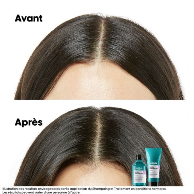 L'Oréal Professionnel Scalp Advanced Intense Soothing Treatment 200ML